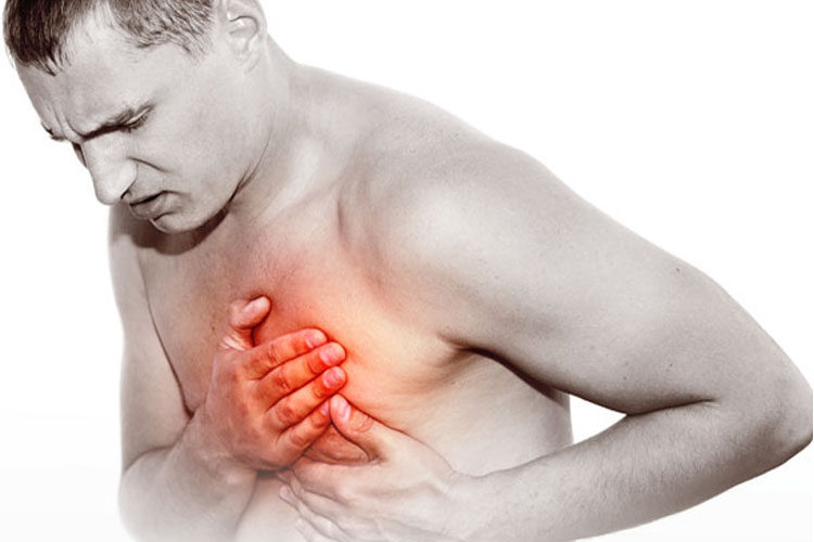 cardiovasculares
